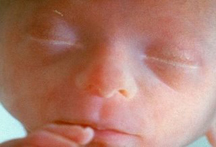 20 weeks