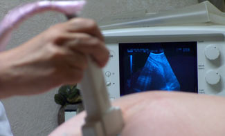 Ultrasound