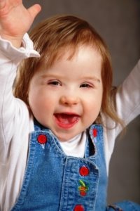 Downs Syndrome