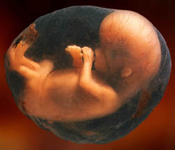 8-week unborn baby