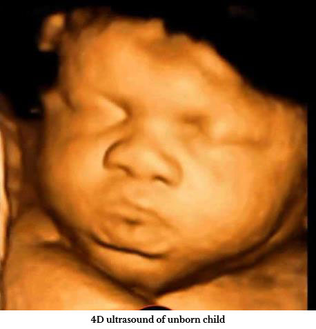 4d Ultrasound Image