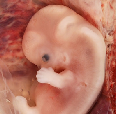 Embryo