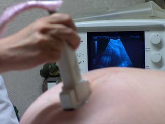 Ultrasound