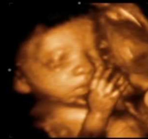 Ultrasound Image