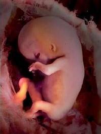 Unborn child